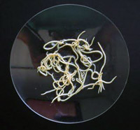 enfermedad ascaridiosis