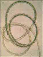 enfermedad capillaria